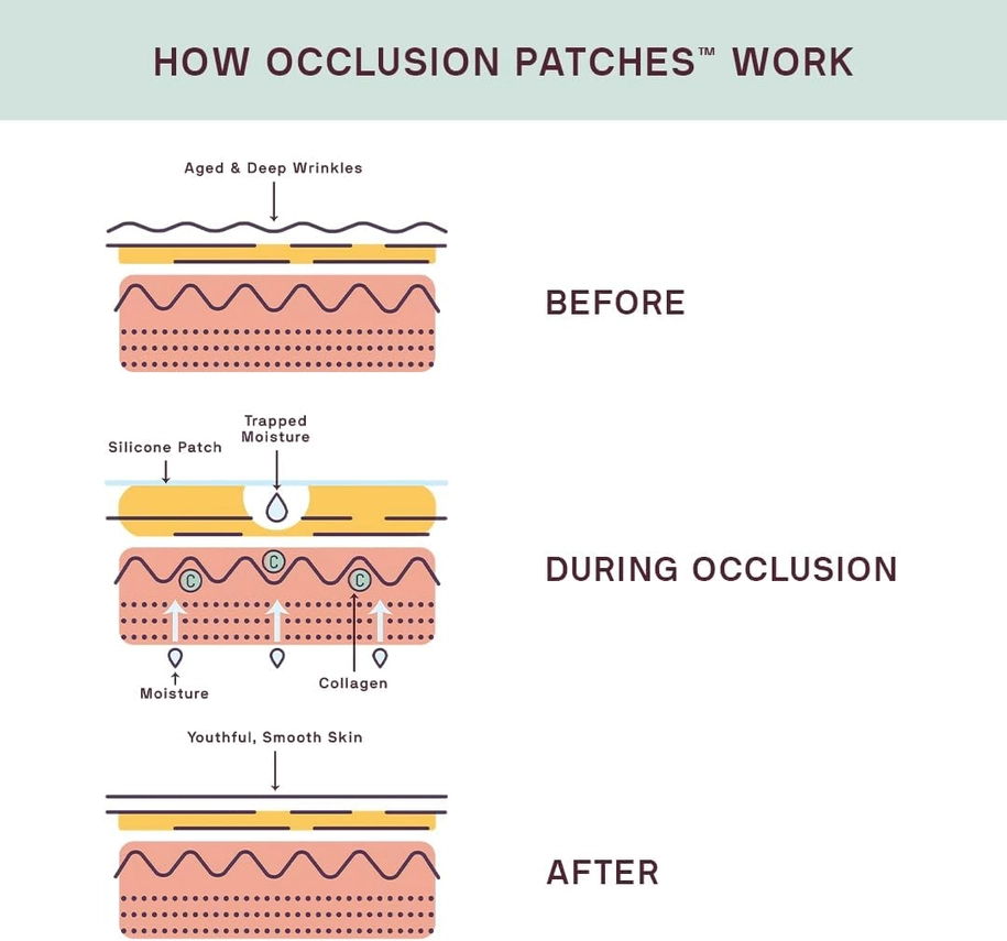 5" Decollete, Breast, & Butt Occlusion Patch™